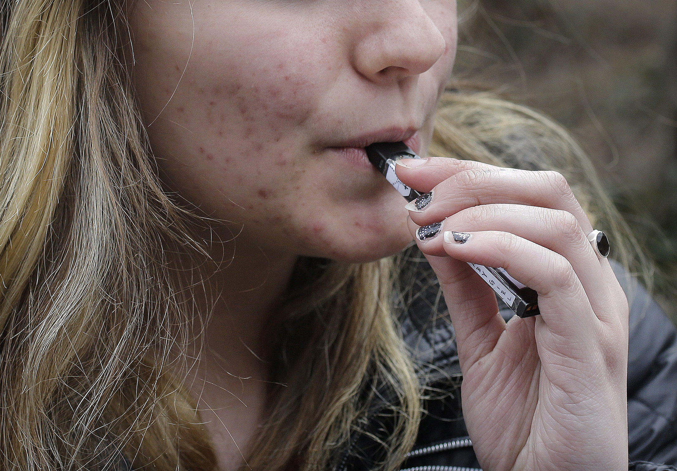 Photo: Teen Vaping - AP Photo