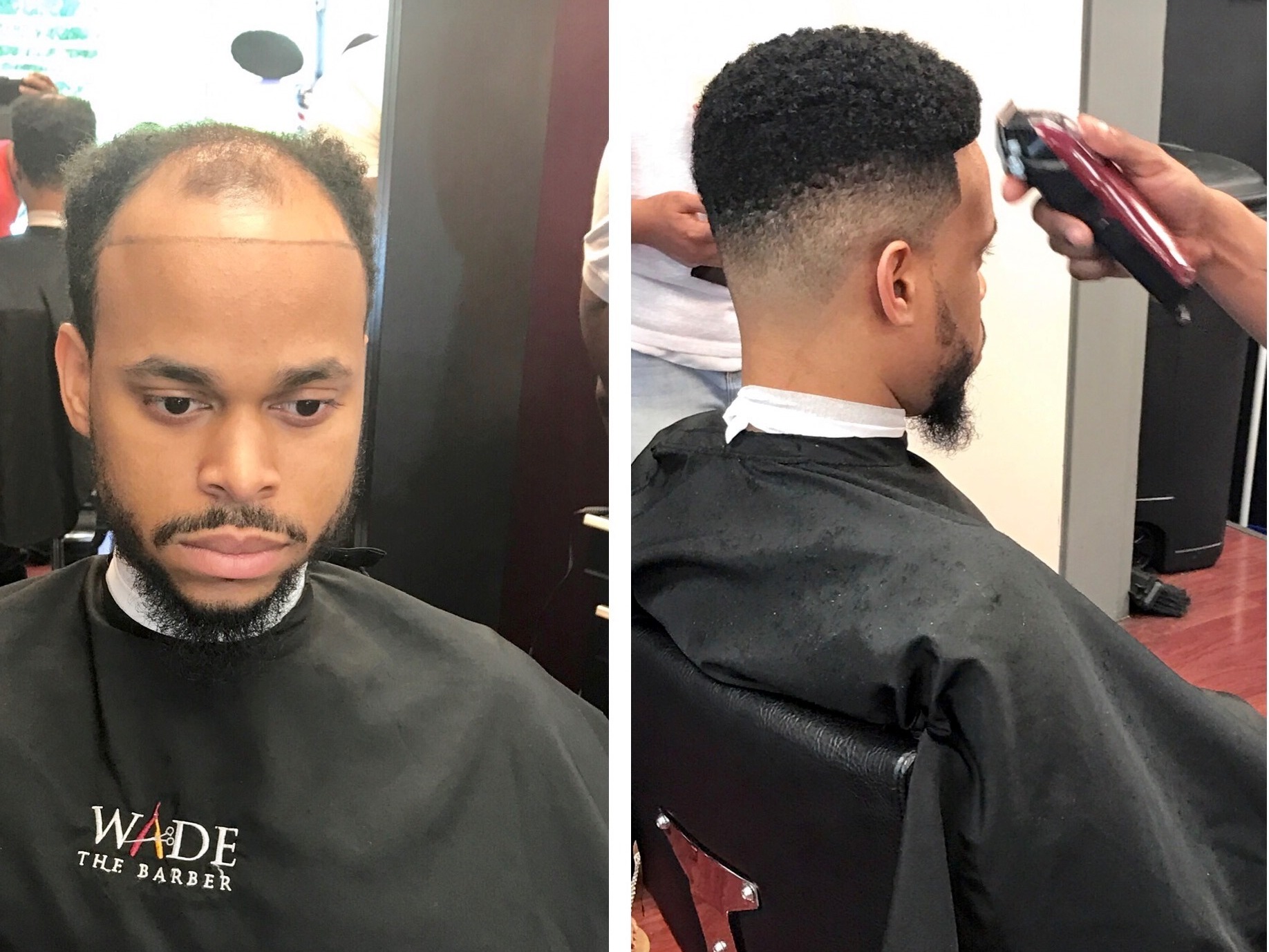 Man Weaves Offer Cover For Balding Men Cash For Black Hair Care