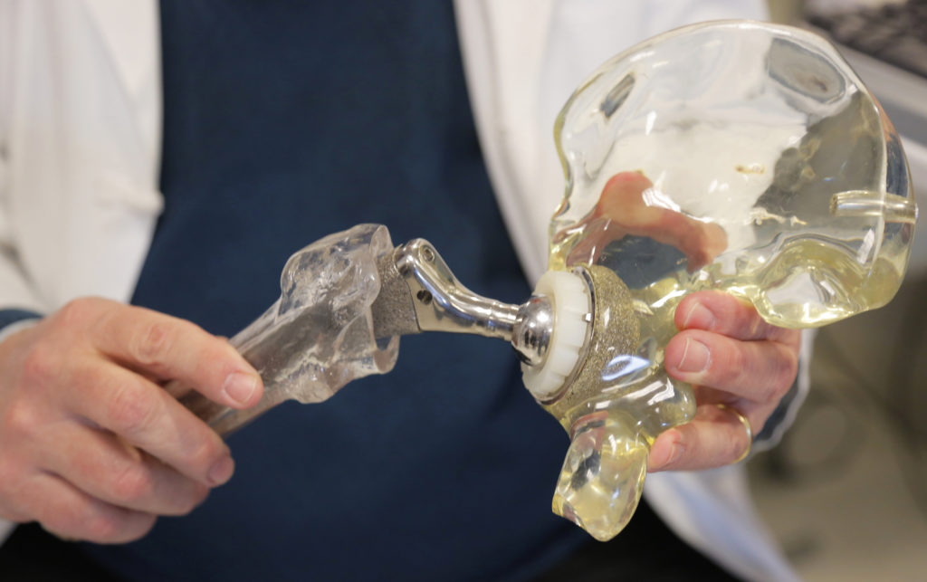 Skip Bone The Mysterious Case Of 'Vanishing Bone' And Hip Replacements Gone Wrong