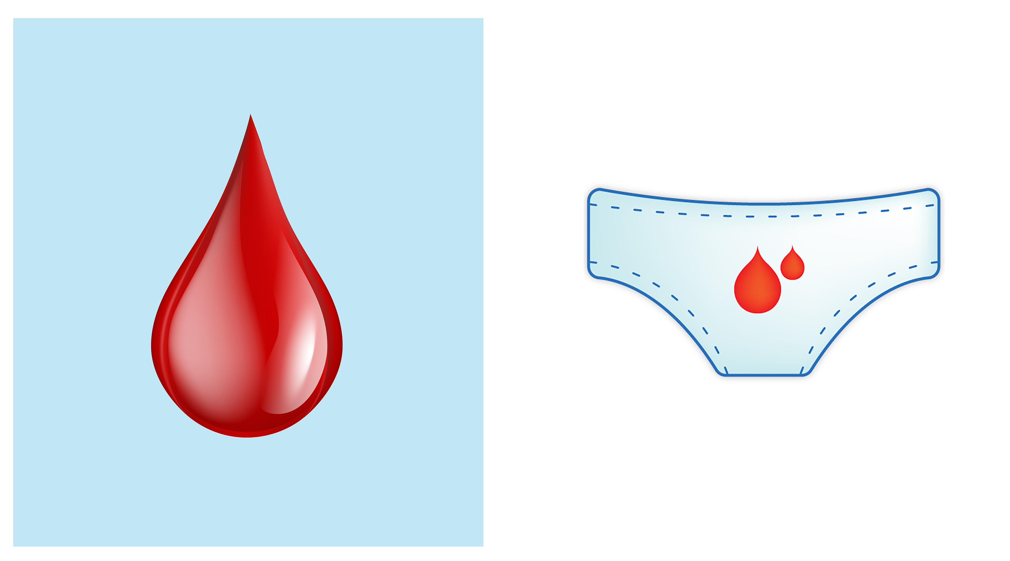 Прокладки женские с кровью. Темно коричневые выделения. Видиление кравинистие. Имплантационное кровотечение беременность. 1 капля месячных.