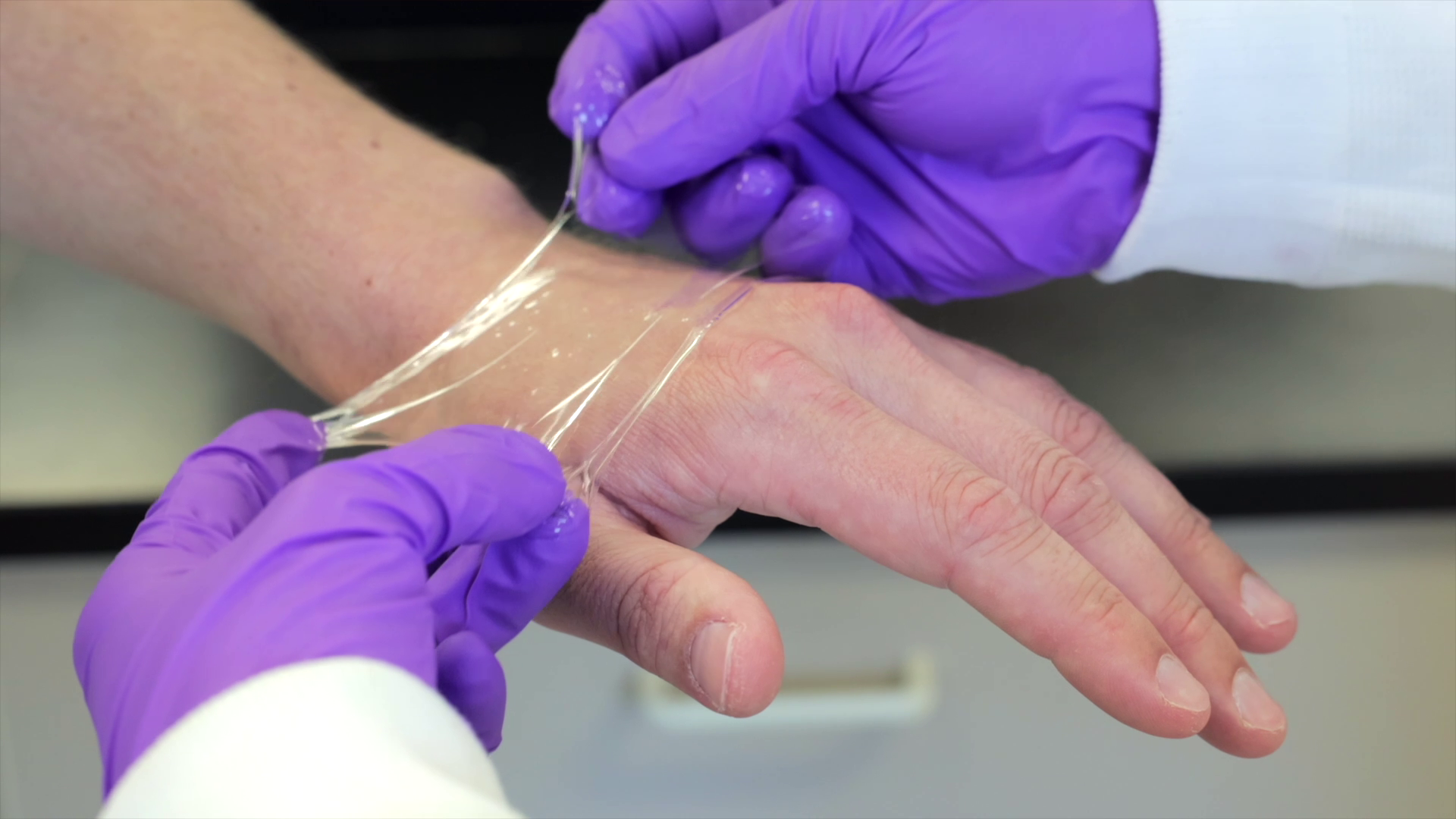 Transparent gel wound dressing could be game changer to help injured people  heal faster